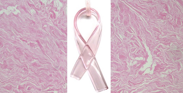 Mammary gland under a lab microscope at 40x.